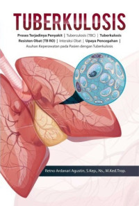 Image of Tuberkulosis